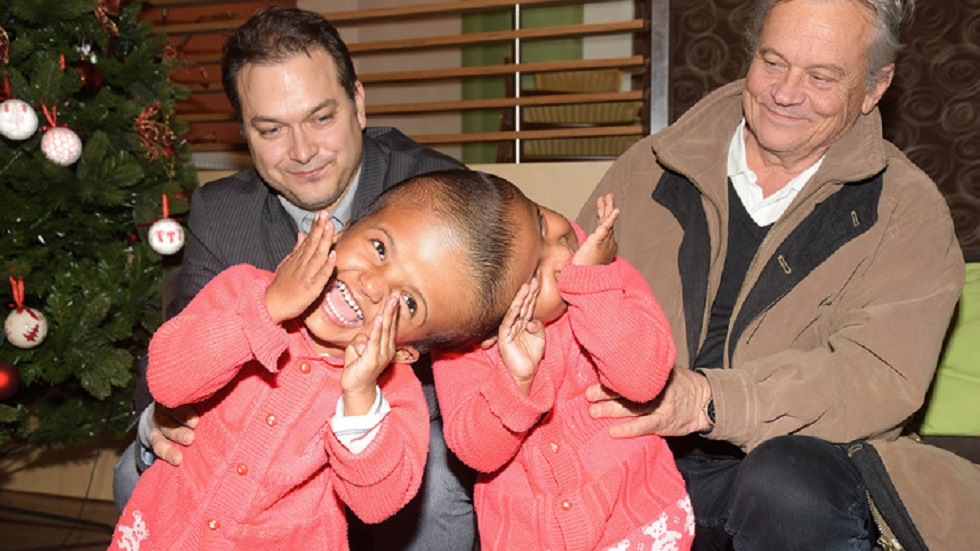 Separan con éxito a siamesas unidas por la cabeza