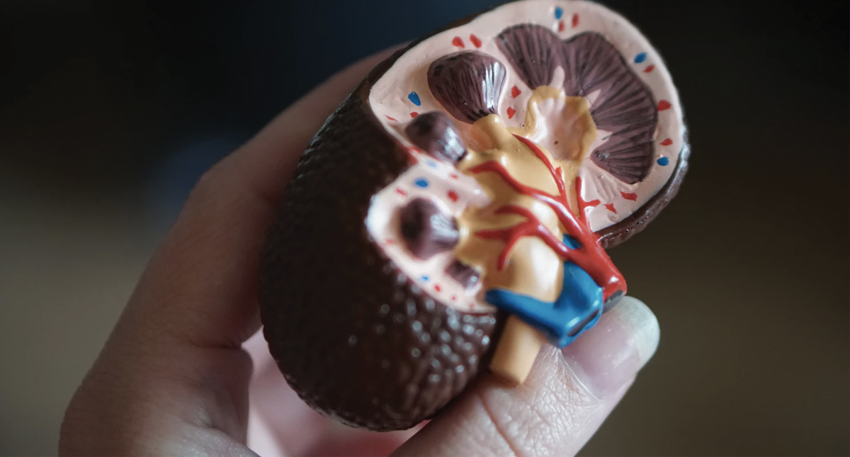 Más 4 mil pacientes esperan trasplante de riñón en Jalisco