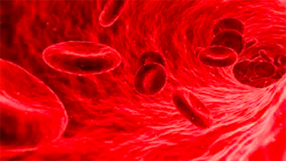 Exigen recursos para atender la Leucemia en el Seguro Popular