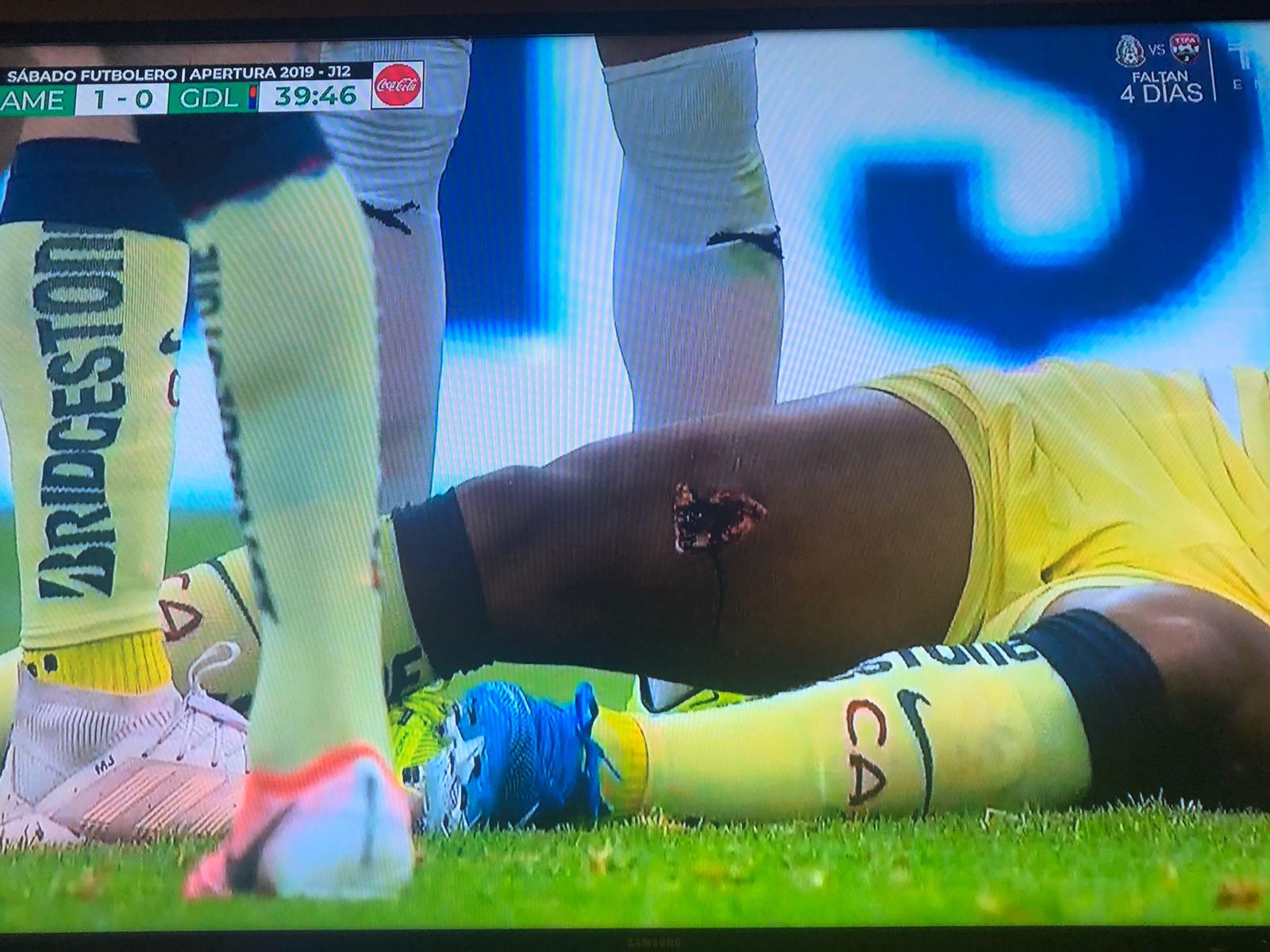 Así fue la aparatosa lesión de Giovani dos Santos - giovani-dos-santos-lesion