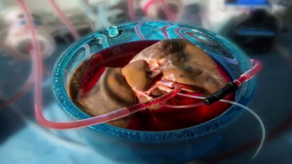 Nueva técnica alarga preservación de hígados para trasplantes