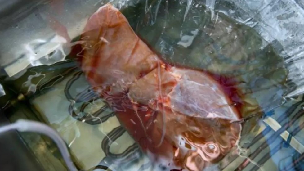 Nueva técnica alarga preservación de hígados para trasplantes - higado