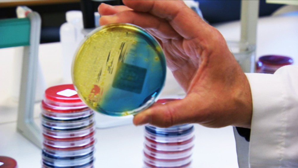 Extraña enfermedad mata a 26 perros en Noruega - pruebas-positivas-a-virus-hallados-en-perros-que-murieron