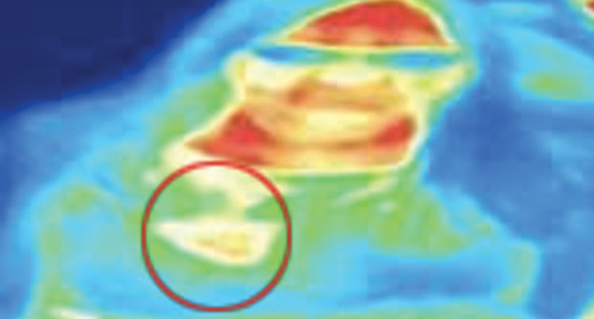 Mujer descubre que padecía cáncer de mama en visita al museo