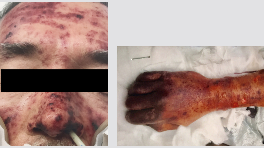 Hombre muere luego de que su perro lo lamiera - alemania-hombre-lamida-perro