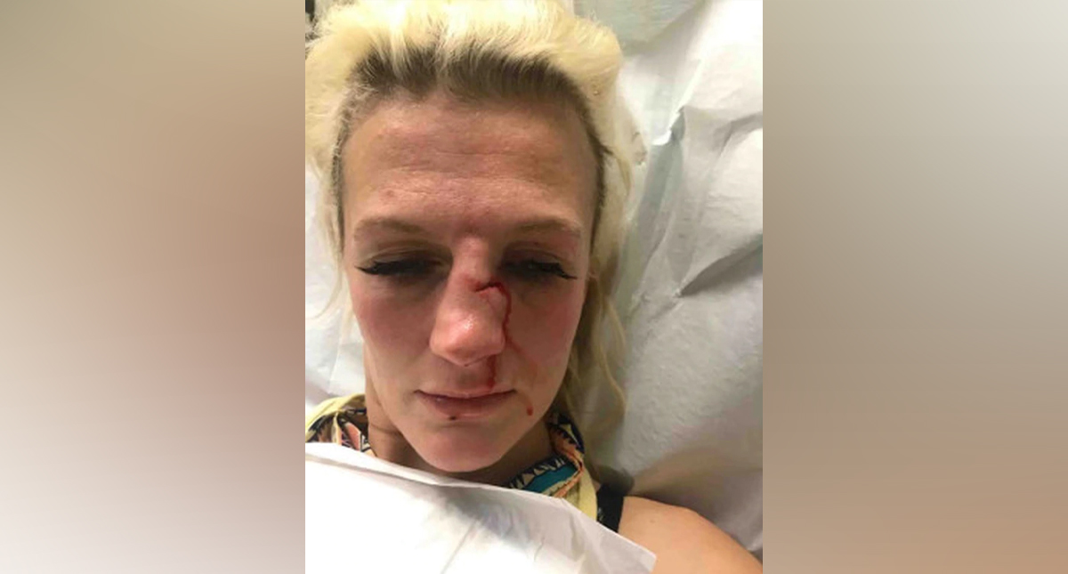 Peleadora de artes marciales mixtas sufre brutal ataque por parte de su exnovio