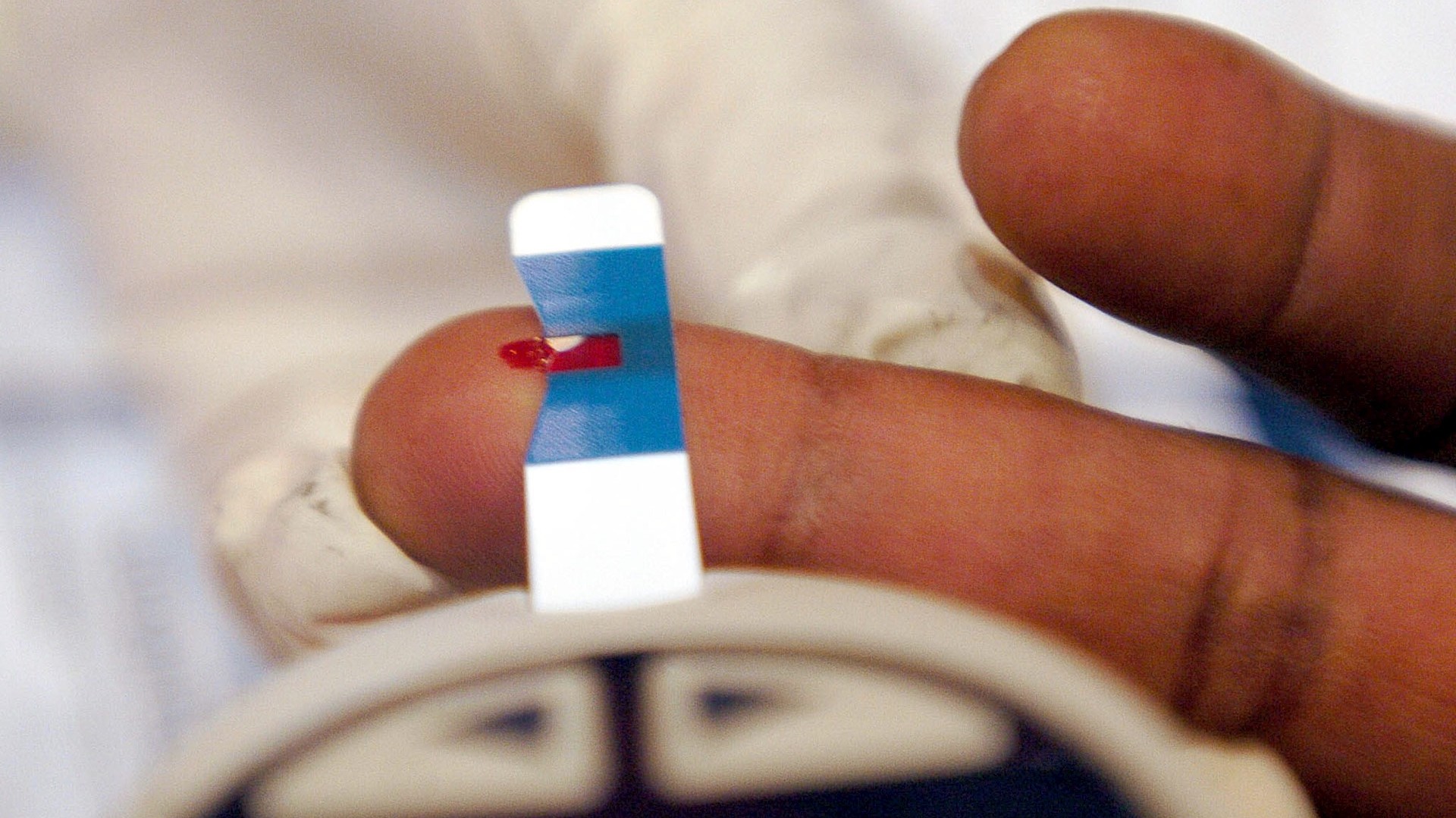 Siete de cada 10 diabéticos tendrán complicaciones crónicas por falta de control