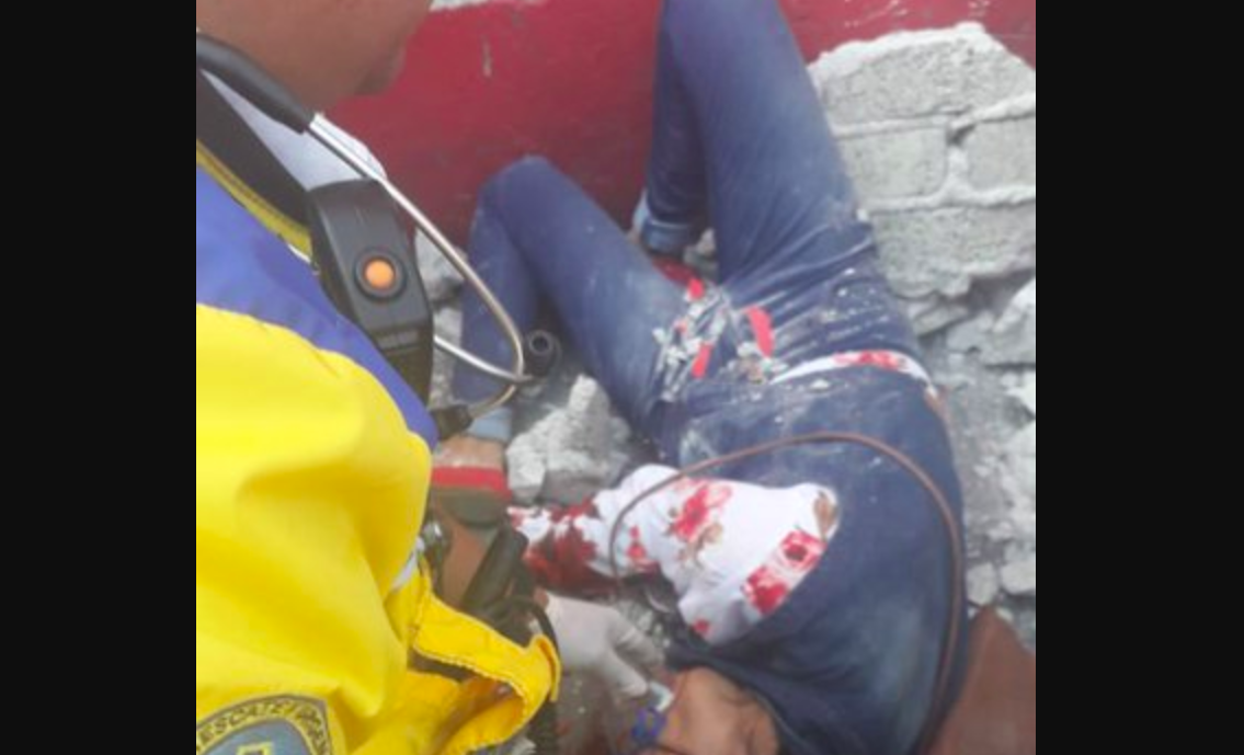 Caída de barda deja una mujer lesionada de gravedad en GAM