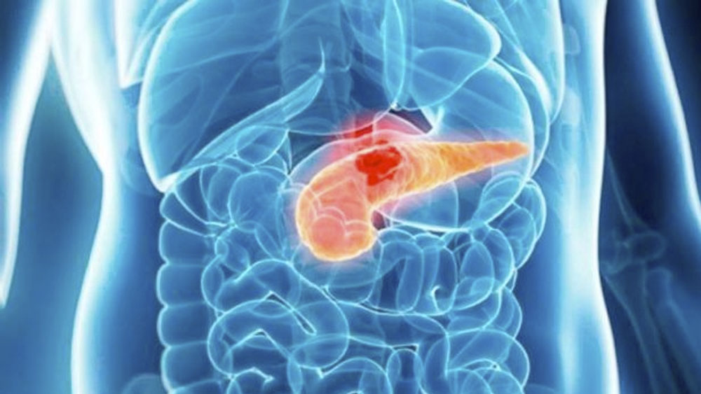 Aumenta tasa de mortalidad en el mundo por cáncer pancreático: estudio