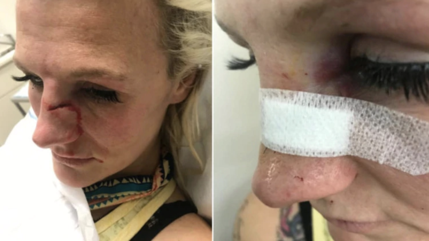 Peleadora de artes marciales mixtas sufre brutal ataque por parte de su exnovio - captura-de-pantalla-2019-11-29-a-las-113319