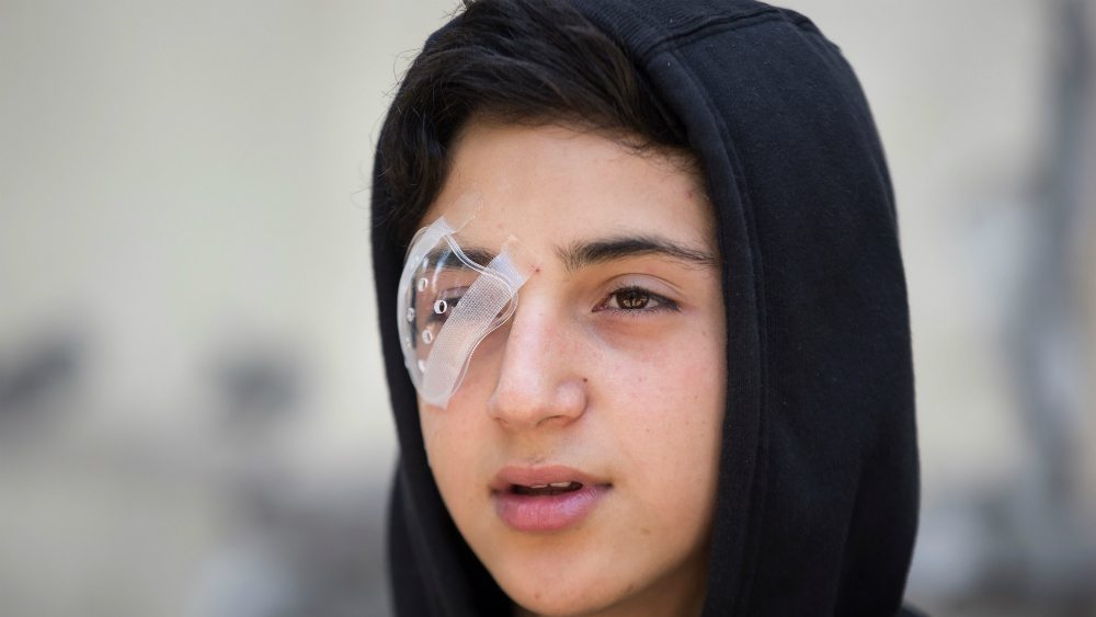 Suman 352 las personas con heridas oculares en protestas en Chile - chile-manifestaciones-lesiones-oculares