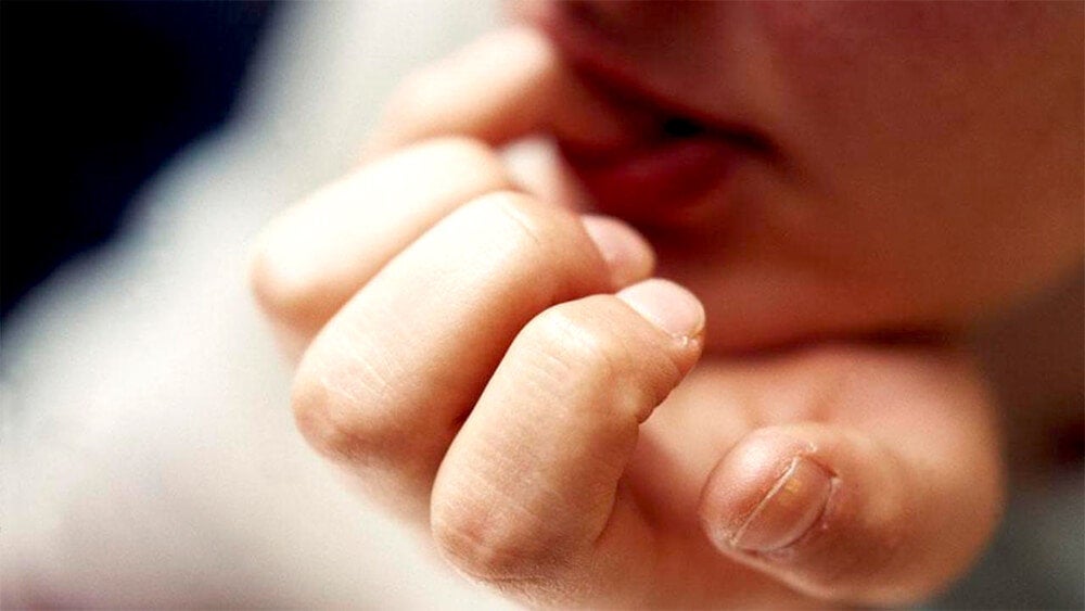 Morderse las uñas deforma los dedos y causa infecciones graves