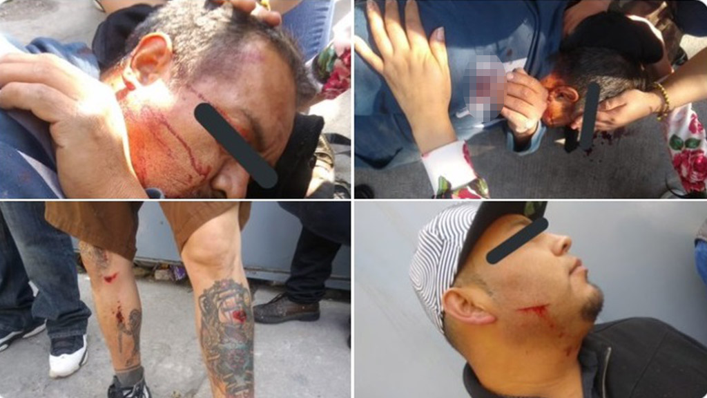 Hieren con petardo a tres albañiles durante protesta en la colonia Anzures - albaniles-lesionados