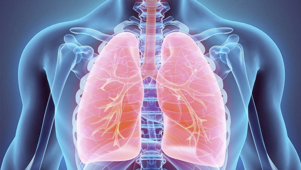 EPOC, tercera causa de muerte en México entre mayores de 45 años