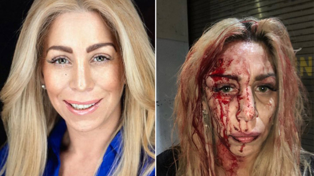 #Video Golpean a actriz y a modelo en bar de Nueva York - jennifer-agostini