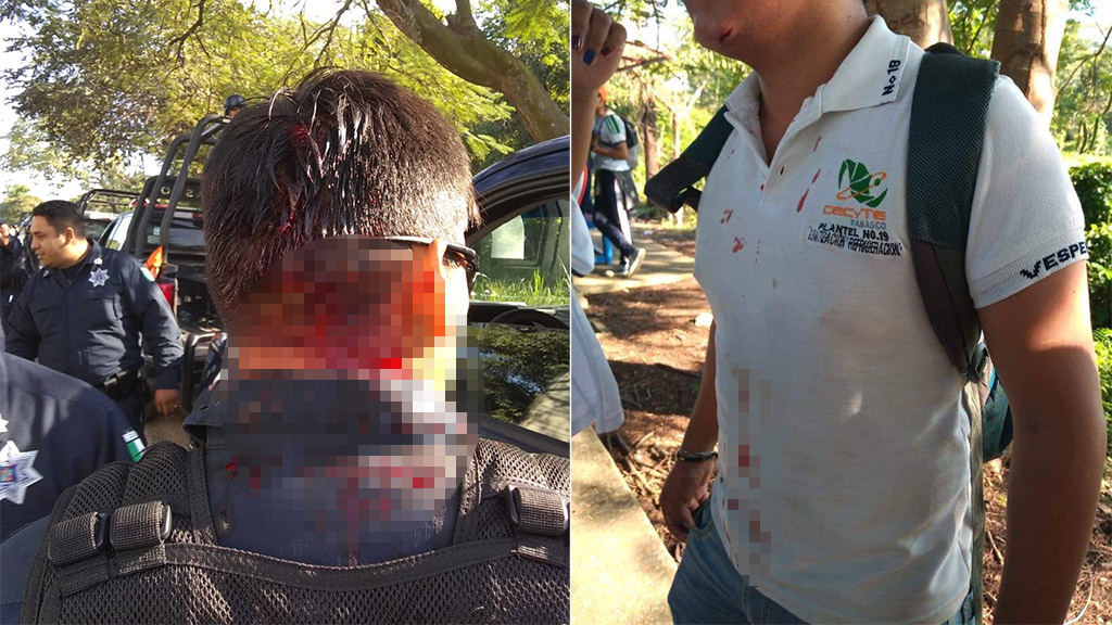 Toma de carretera por falta de pago de becas en Tabasco deja dos heridos - policia-y-alumno-herido-en-bloqueo-de-carretera-de-tabasco