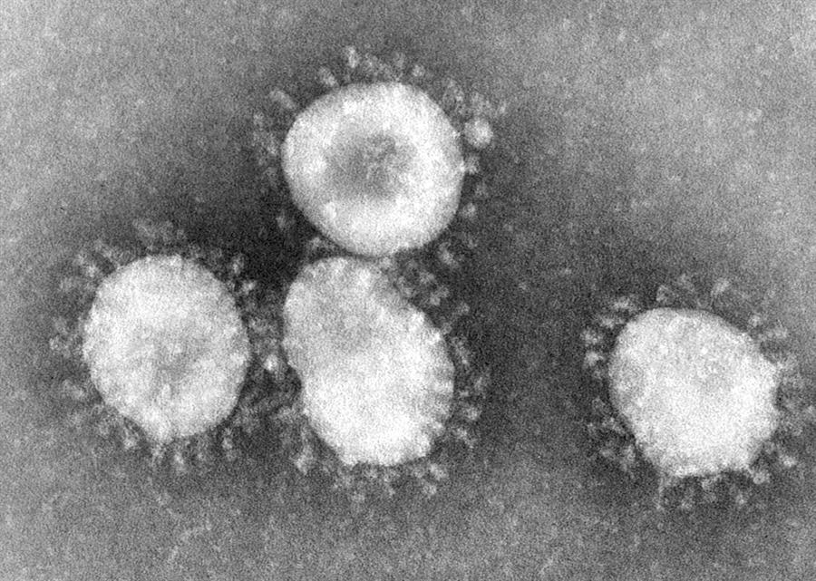 Un virus similar al SARS, responsable del misterioso brote de neumonía en China