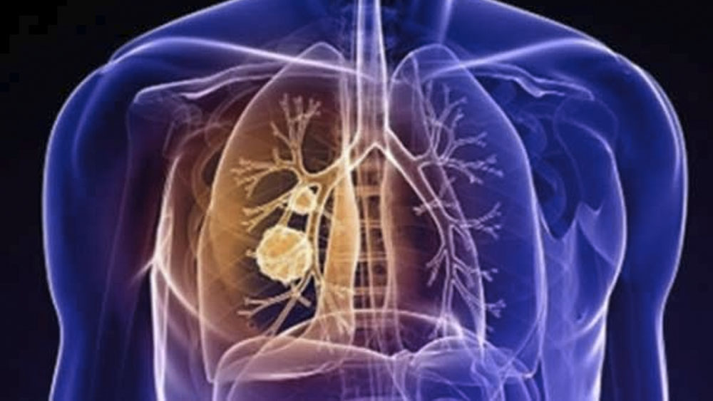 Combinación de fármacos es eficaz en ratones contra cáncer por amianto