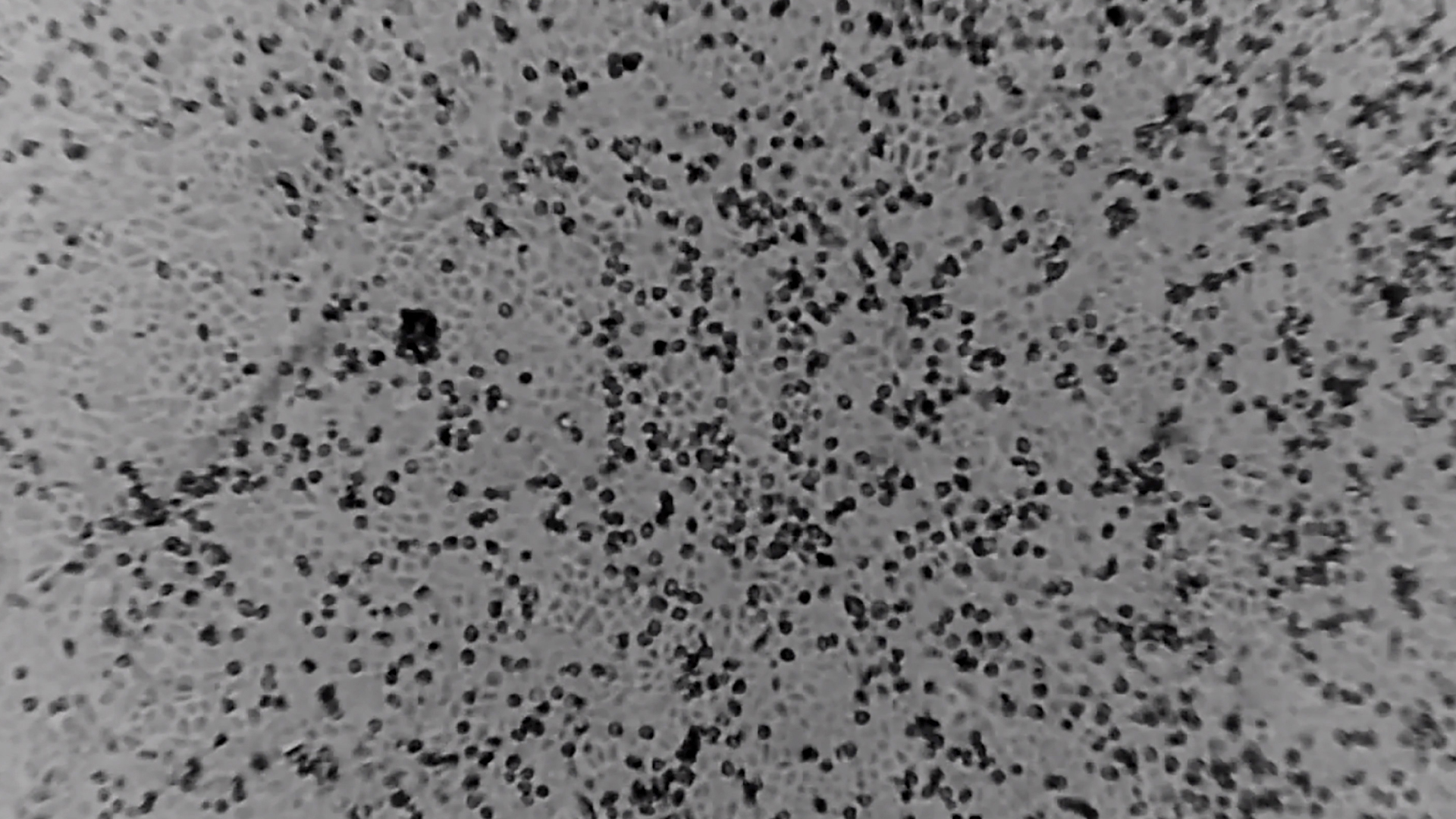 Científicos de Australia reproducen virus causante de la neumonía de Wuhan