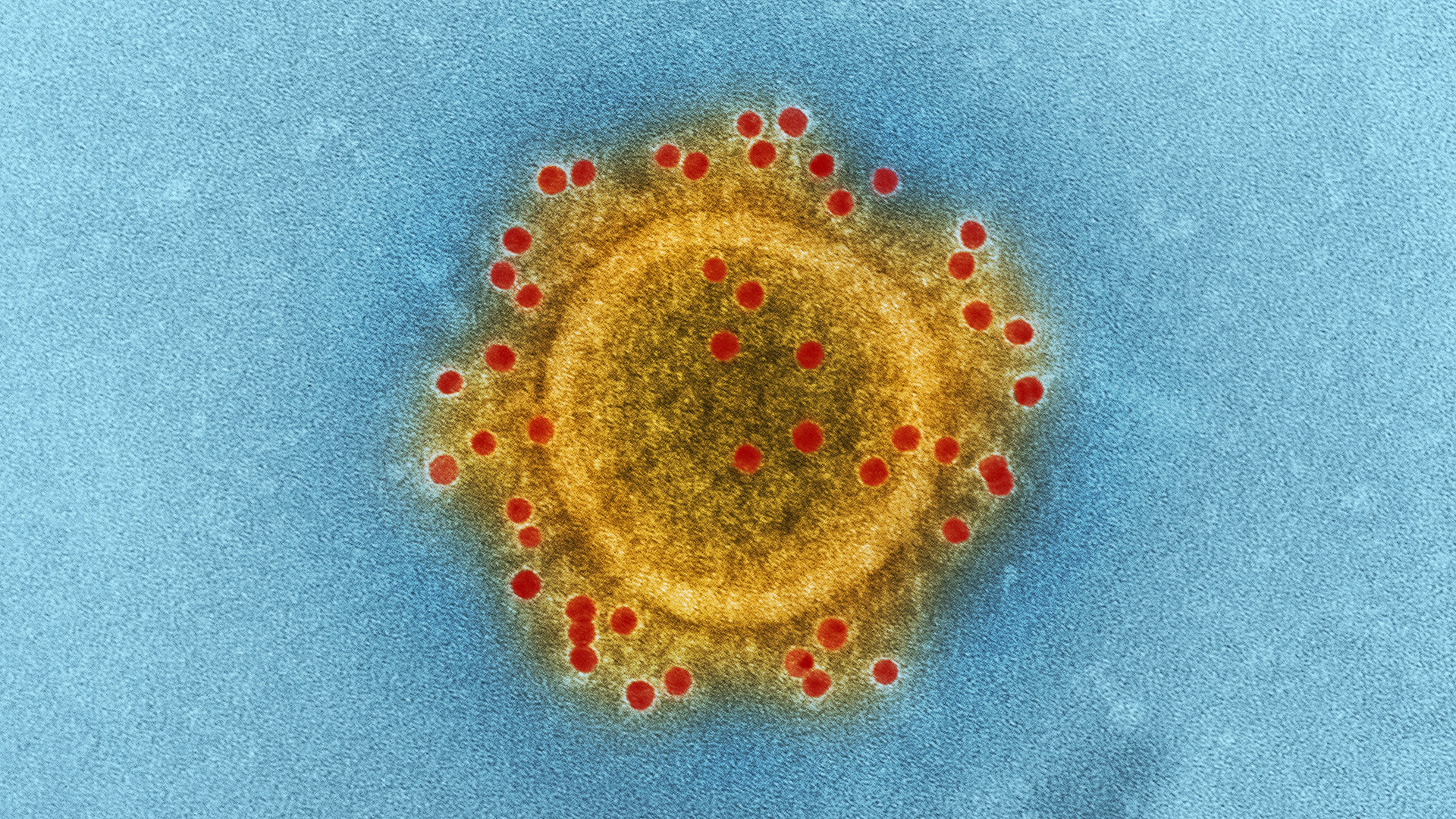 Honduras activa plan de vigilancia epidemiológica por coronavirus Honduras activa plan de vigilancia epidemiológica por coronavirus