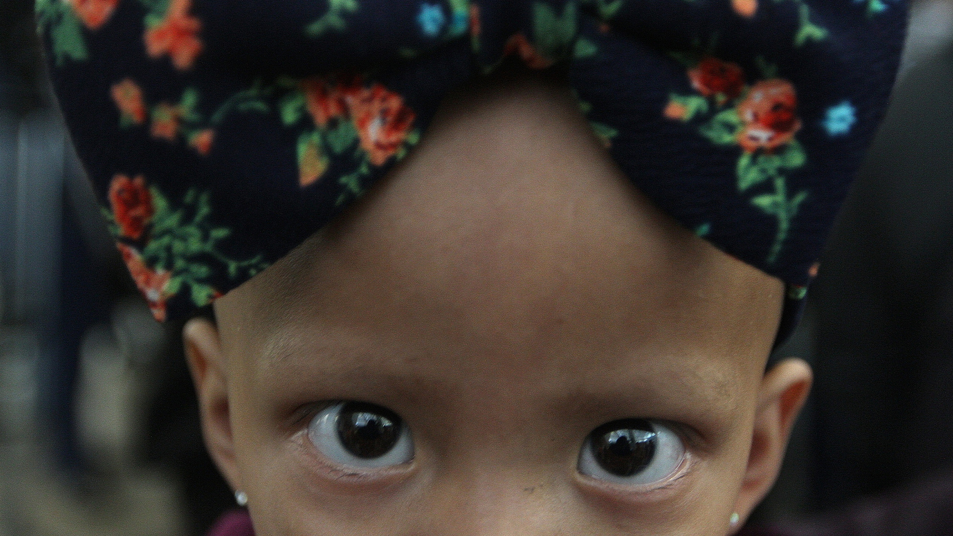 Piden activar en México el 'Código cáncer' para atención integral a pacientes - nina-con-cancer