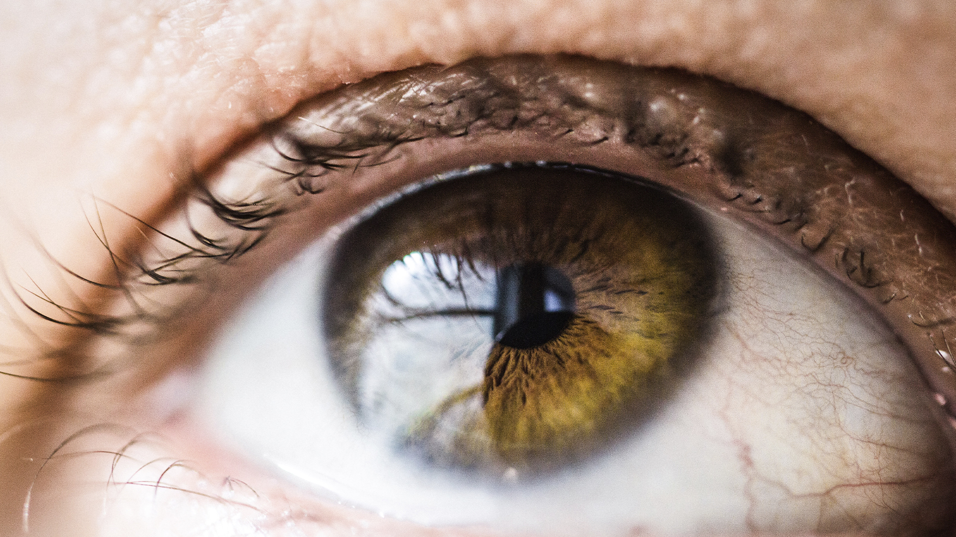 UNAM usa inteligencia artificial para detectar retinopatías