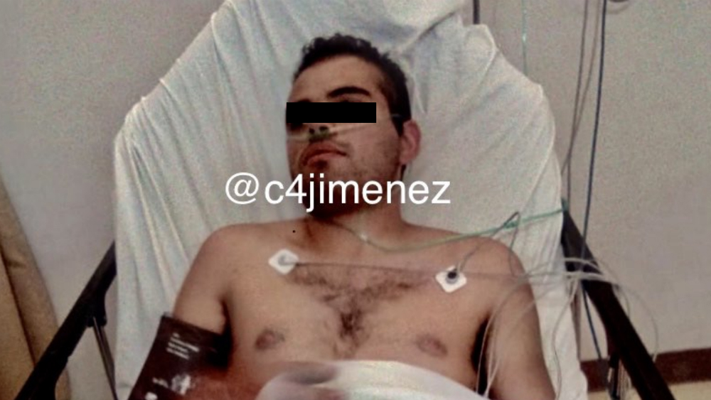 Se recupera primer ladrón baleado de 2020