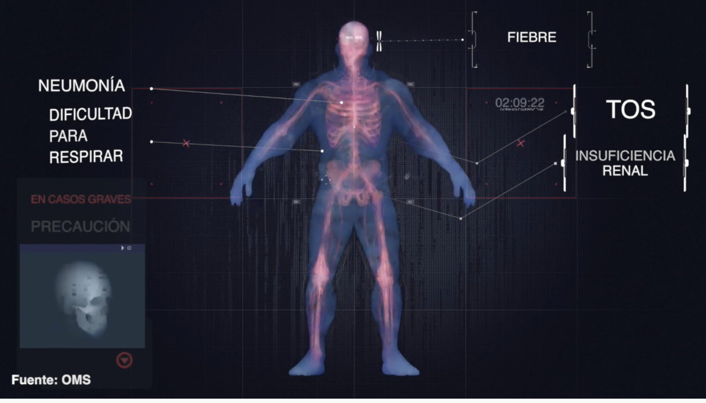 ¿Cuáles son los síntomas del coronavirus?