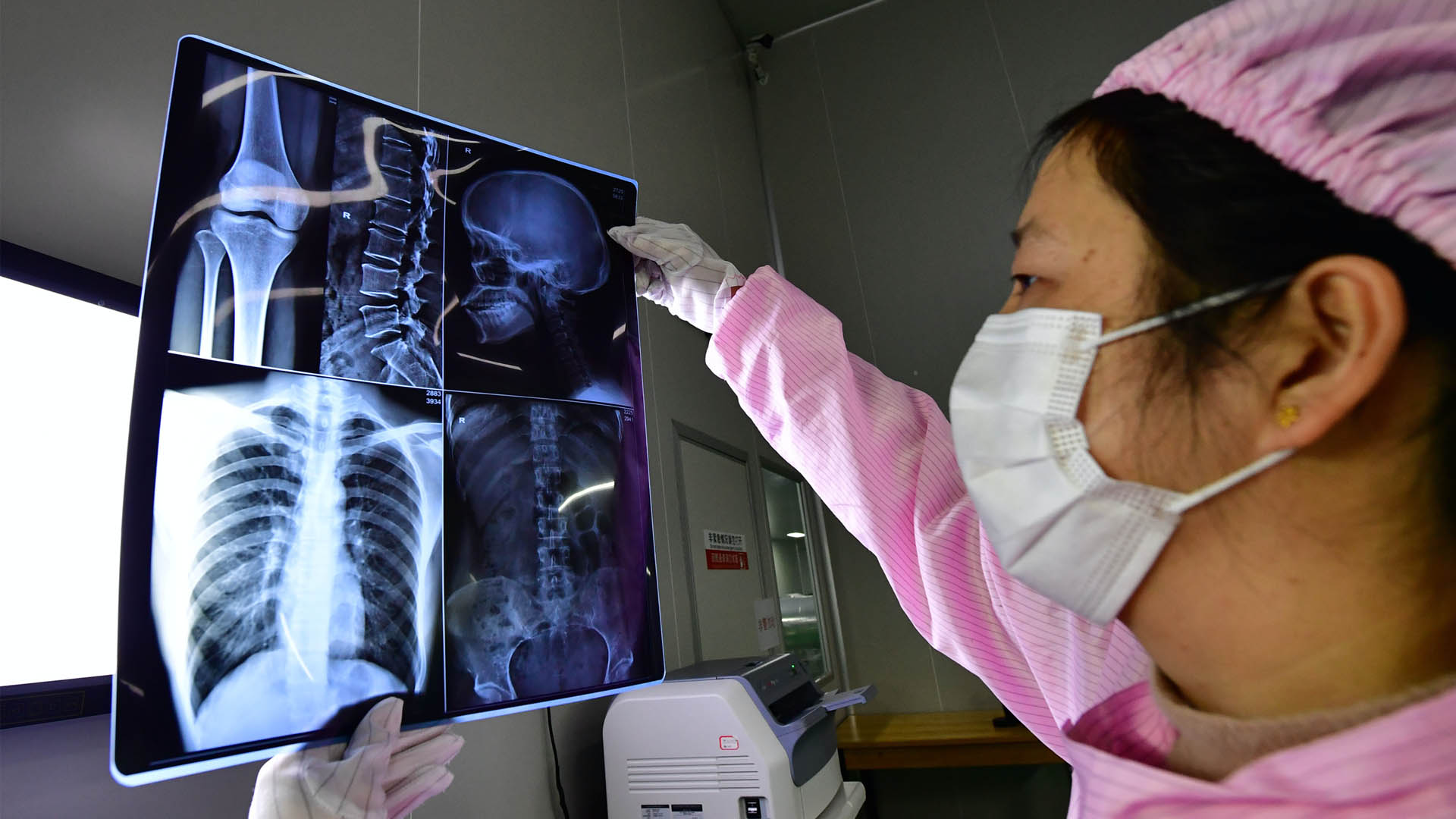 Descartados los dos casos sospechosos de Covid-19 en México Descartados los dos casos sospechosos de Covid-19 en México