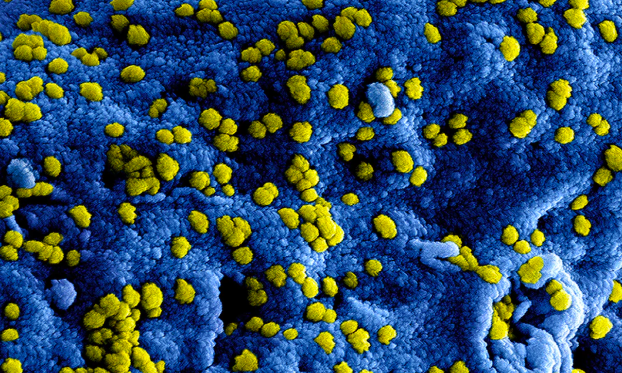 Al menos 41 muertos por brote de fiebre de Lassa en Nigeria Al menos 41 muertos por brote de fiebre de Lassa en Nigeria