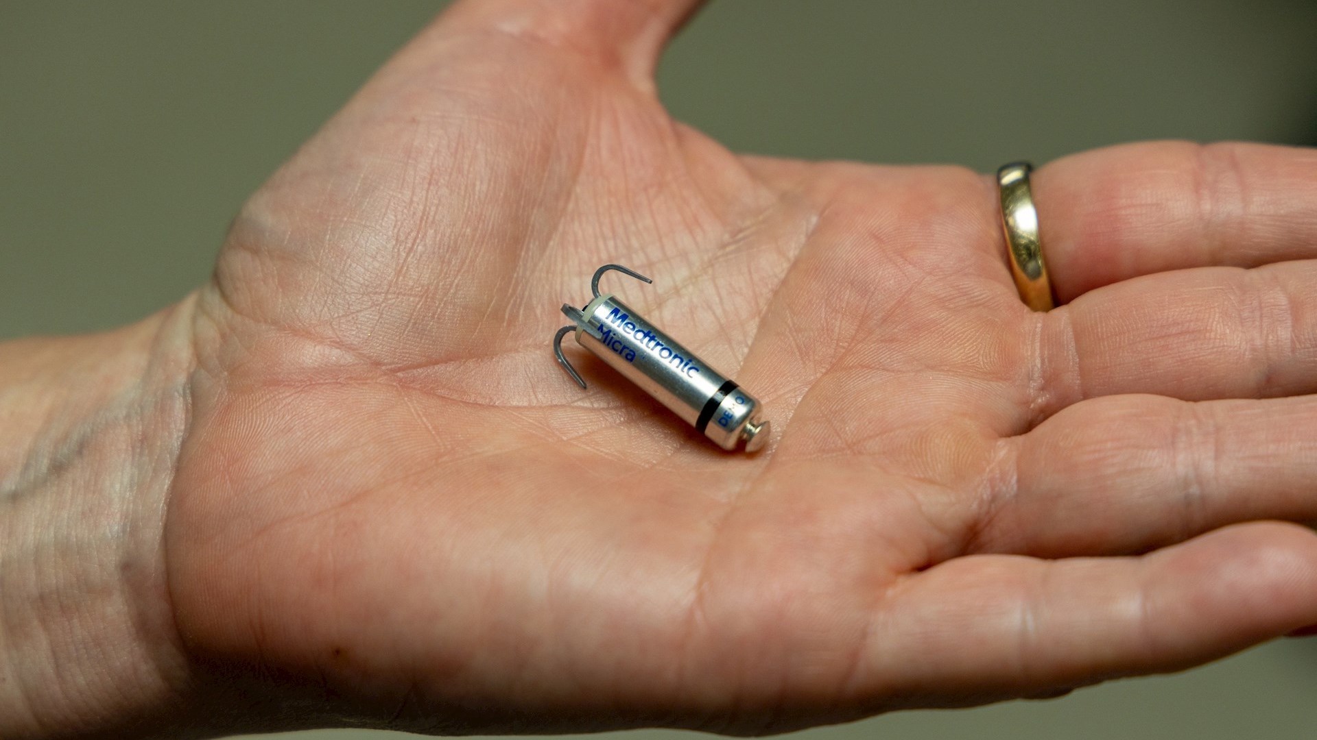 Implante de marcapasos más pequeño del mundo salva una vida en EE.UU.