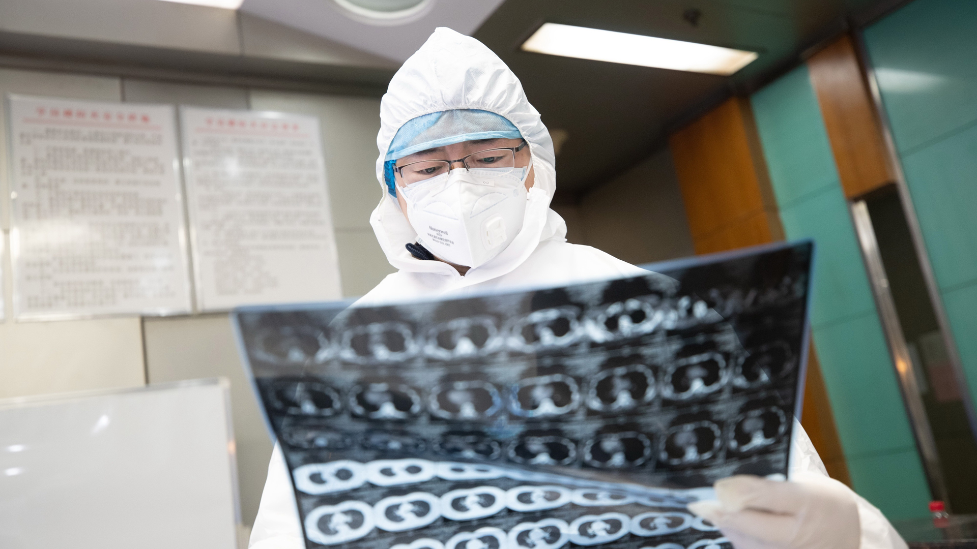 Bebé nace con coronavirus en Wuhan