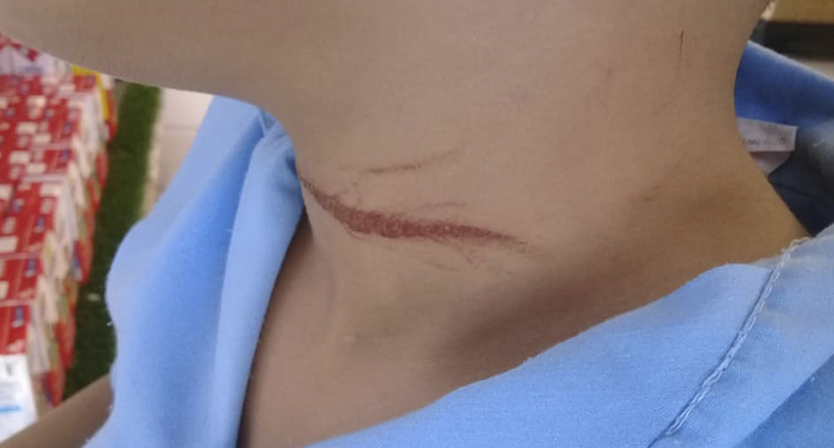 Niño corta garganta a compañero en escuela primaria de Veracruz - nino-al-que-companero-le-corto-el-cuello-en-veracruz