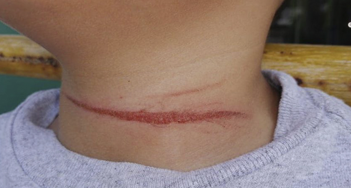 Niño corta garganta a compañero en escuela primaria de Veracruz