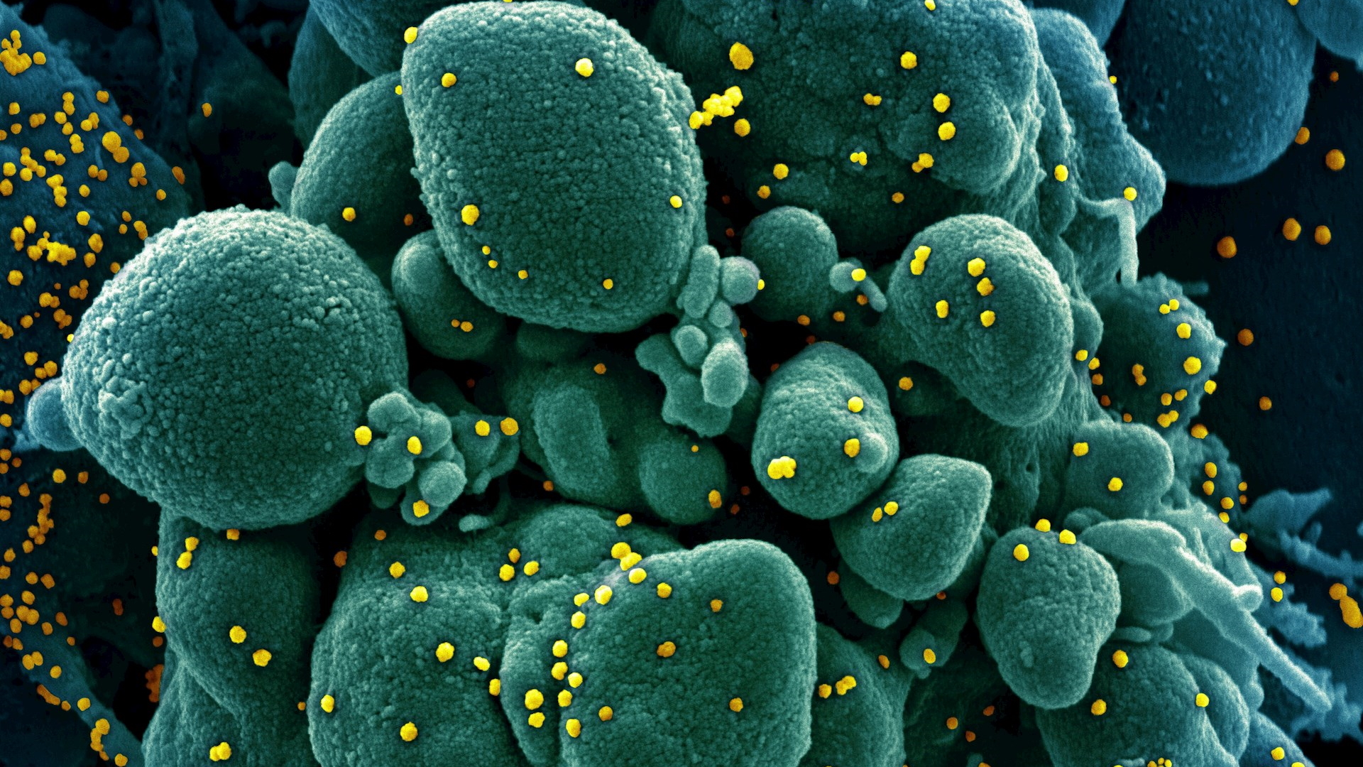 Permiten en EE.UU. usar sangre de personas curadas de COVID-19 para tratar a pacientes graves