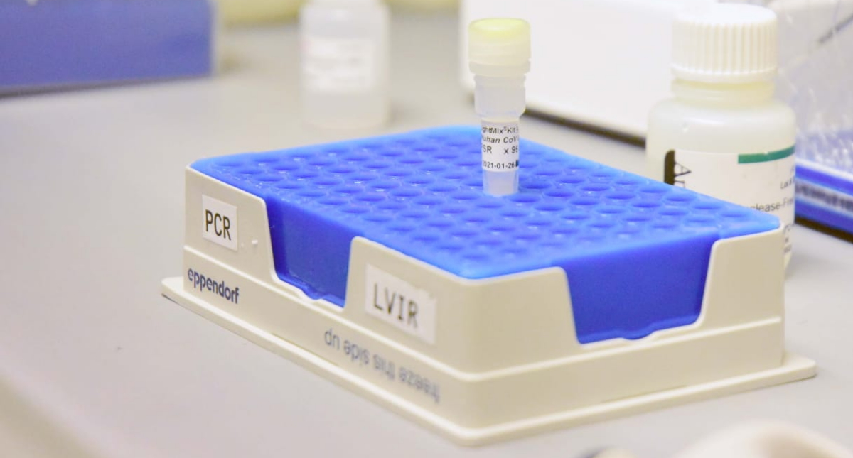 UNAM pone a disposición de la comunidad prueba de COVID-19 UNAM pone a disposición de la comunidad prueba de COVID-19