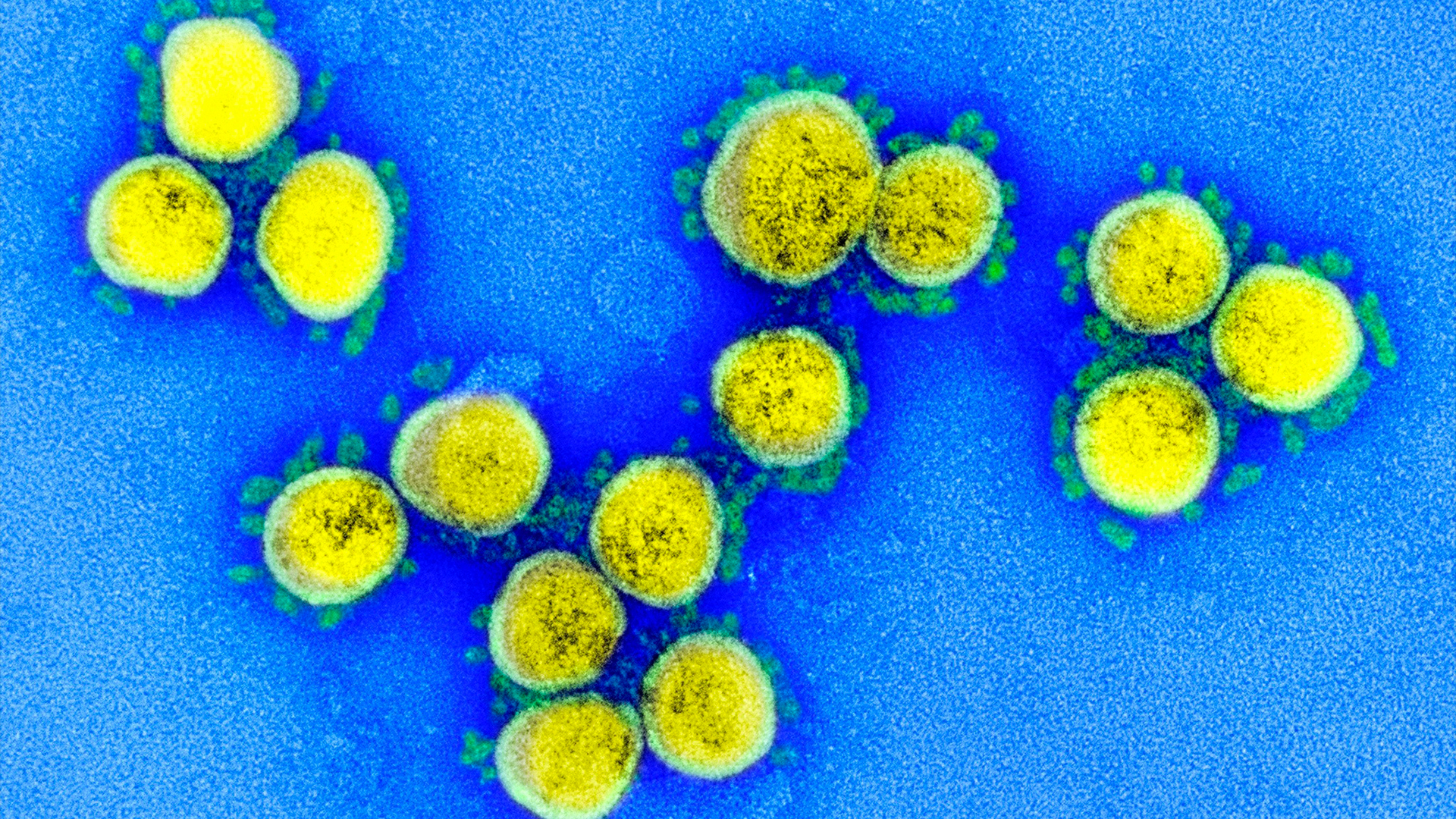 Investigan compuestos y fármacos existentes que podrían combatir el COVID-19