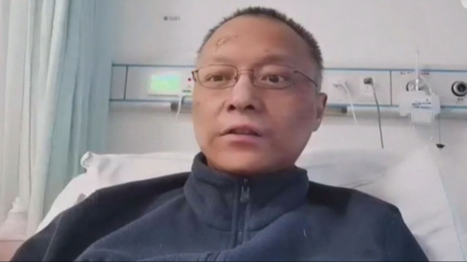 Problema hepático por COVID-19 provoca cambio en el color de piel