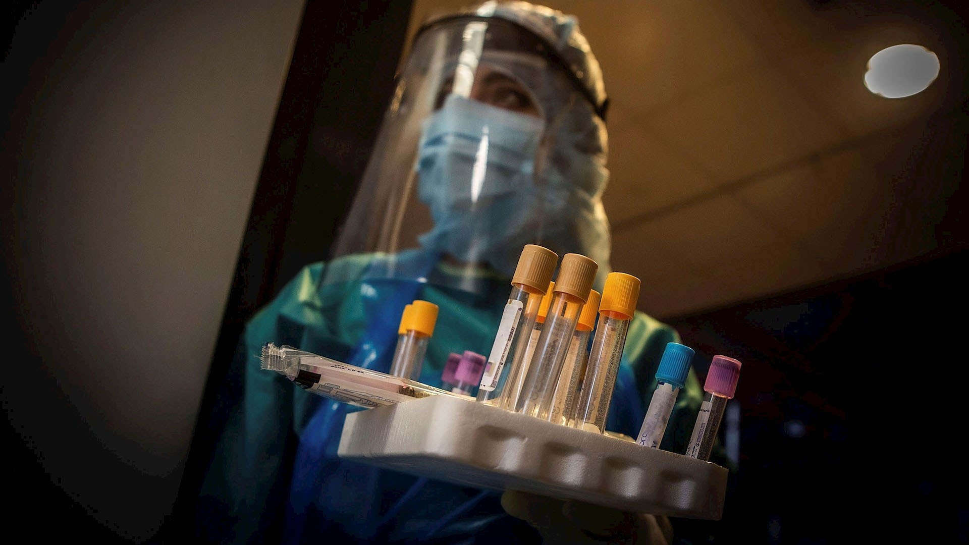 Pérdida grave del gusto y olfato por COVID-19 se asocia con menor probabilidad de hospitalización - espana-coronavirus-covid-19-8