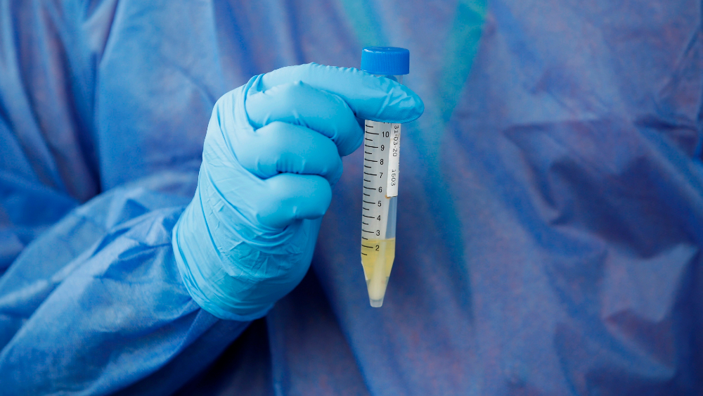 Casos globales de COVID-19 ascienden a 1.84 millones, con indicios de ralentización