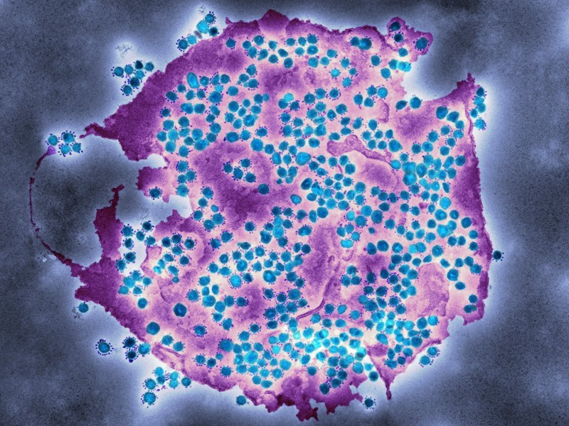 Identifican en la nariz células que facilitarían entrada del COVID-19 al cuerpo - particulas-azul-del-virus-que-causa-covid-19