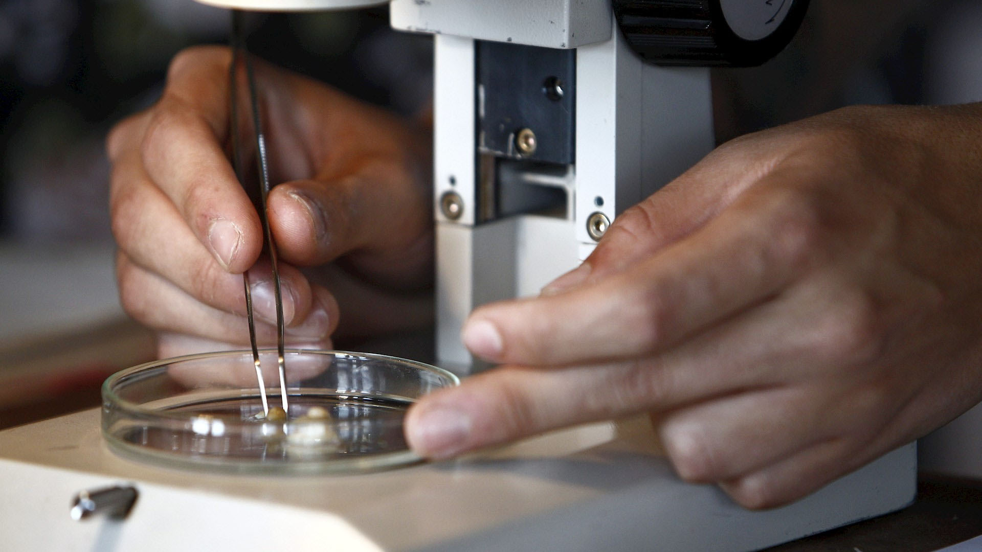 Científicos descubren anticuerpos que bloquean infección de COVID-19 en células