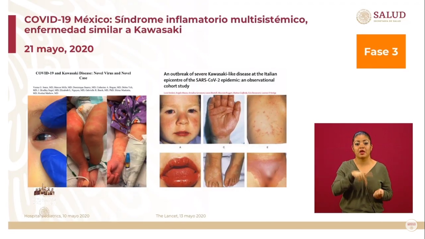 Han muerto 24 menores de 20 años por COVID-19 en México - enfermedad-de-kawasaki