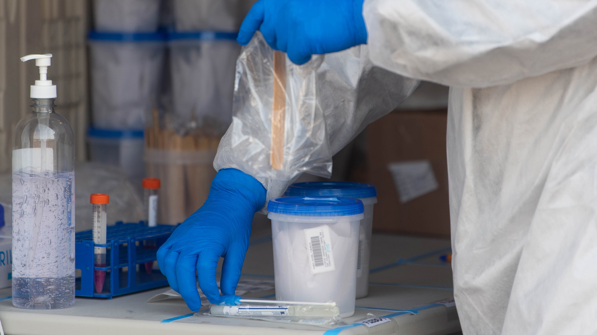 Investigar el origen del COVID-19 "no consiste en buscar culpables": OMS - muestra-para-diagnosticar-covid-19