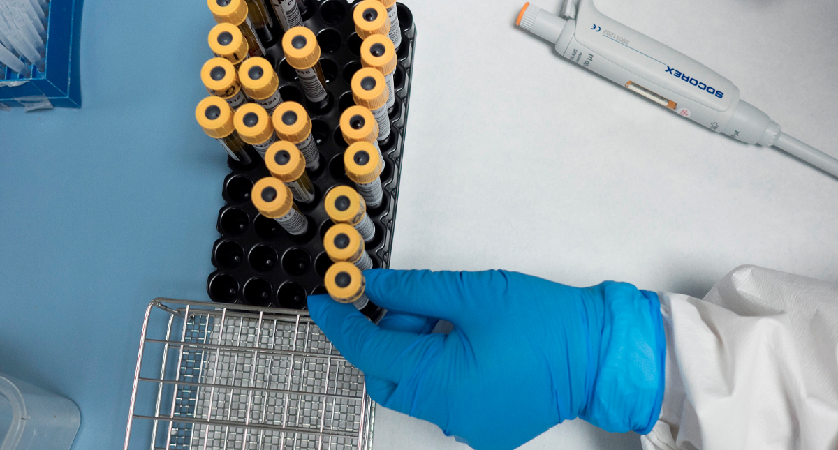 Muestra de sangre podría indicar probabilidad que pacientes empeoren por COVID-19