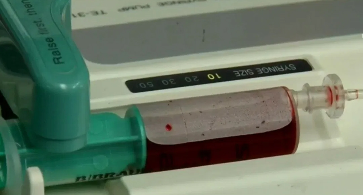 IMSS trata a pacientes graves de COVID-19 con plasma de personas recuperadas