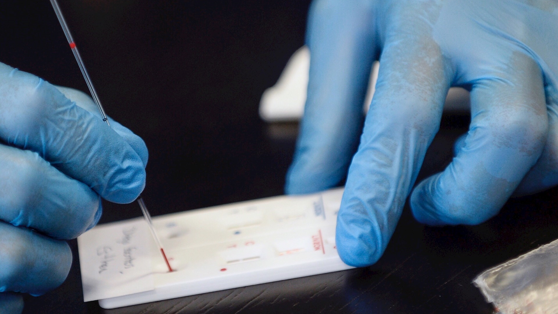 Cofepris aprueba cuatro pruebas serológicas, suman siete