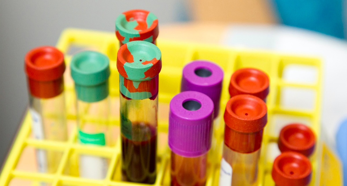 Cofepris no ha autorizado pruebas serológicas en México