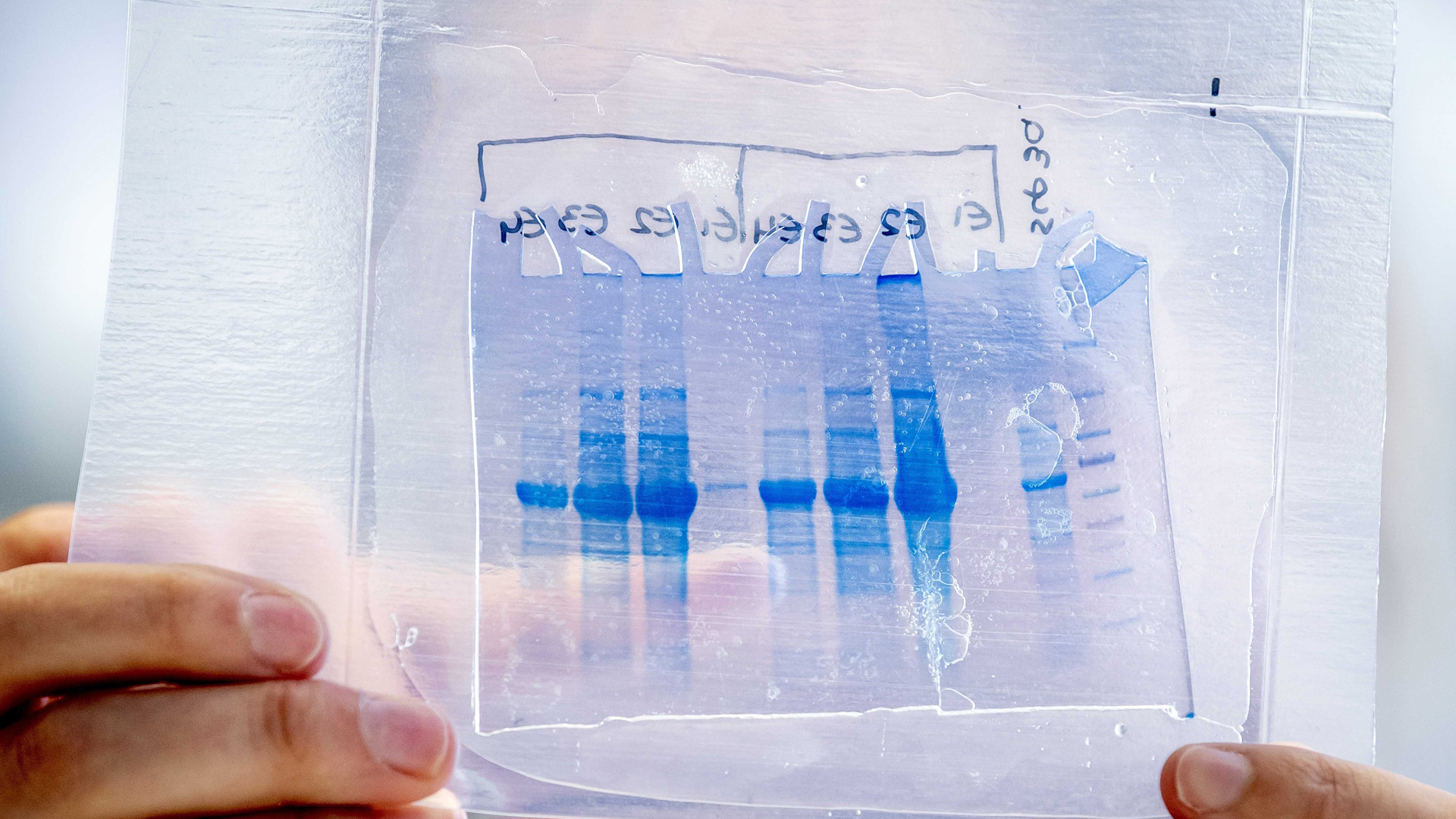 ONU pide solidaridad mundial para cuando haya vacuna contra COVID-19