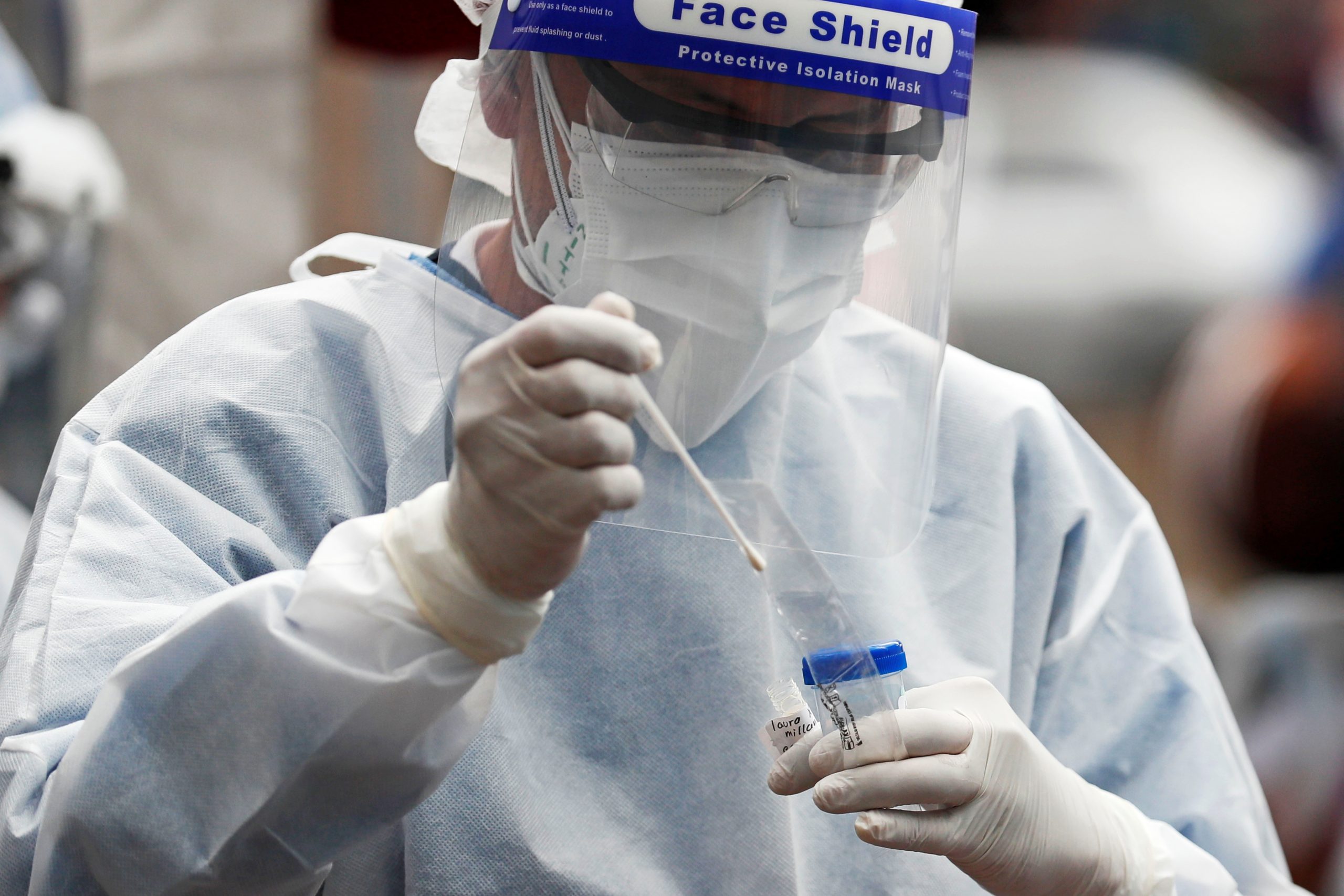 Una de cada cinco personas sufriría una forma severa de COVID-19 en caso de contagiarse Una de cada cinco personas sufriría una forma severa de COVID-19 en caso de contagiarse